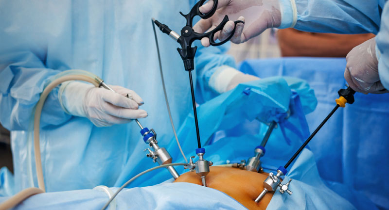 Doctor for Laparoscopic Surgery in Andheri